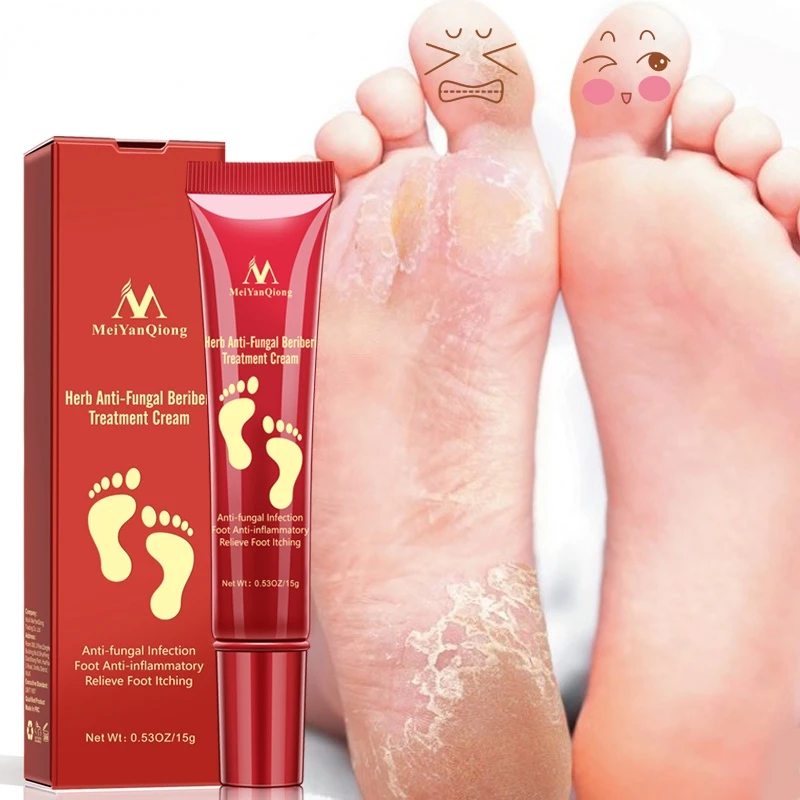 

Herbal Foot Cream Anti Dry Crack Moisturizing Feet Care Anti Fungal Infection Onychomycosis Athletes Foot Antibacterial Cream