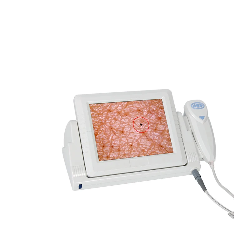 

Цифровой ЖК-Лупа AYJ-J015(CE) для детектора кожи, портативный цифровой микроскоп