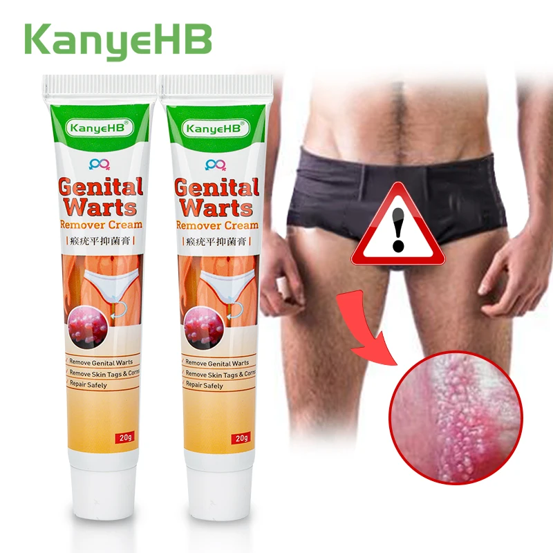 2pcs Wart Remover Ointment Genital Herpes Vulva Condyloma Acuminatum Skin Tag Antibacterial Treatment Cream A658 | Красота и здоровье