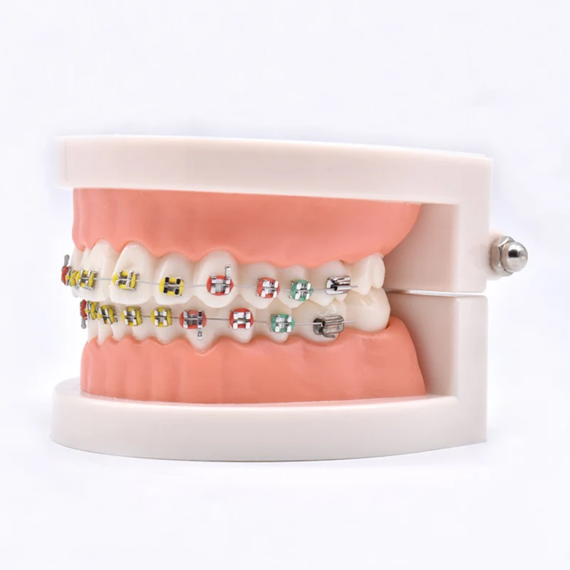 Стоматологическая модель кариеса обучающая зуба уход за зубами для обучения