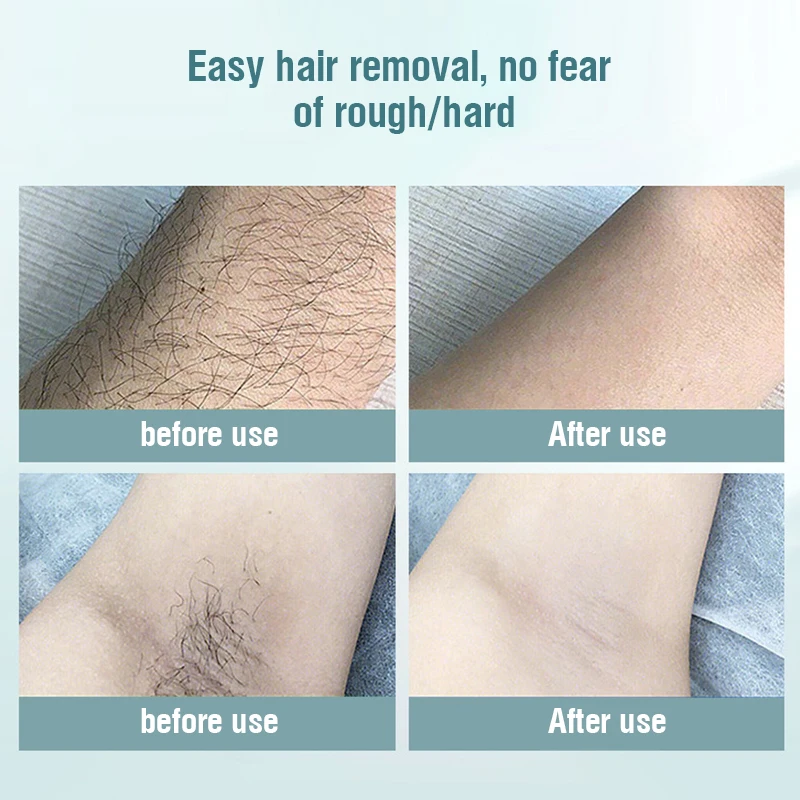 

IPL Laser Hair Removal Machine 900000 Flash Epilator For Women Permanent Photoepilator Painless Depiladora Facial