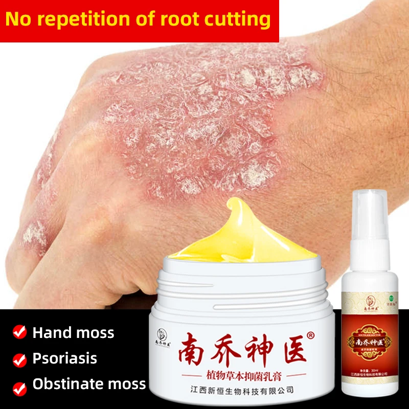 Крем для лечения псориаза дерматита экземы 30 г | Красота и здоровье