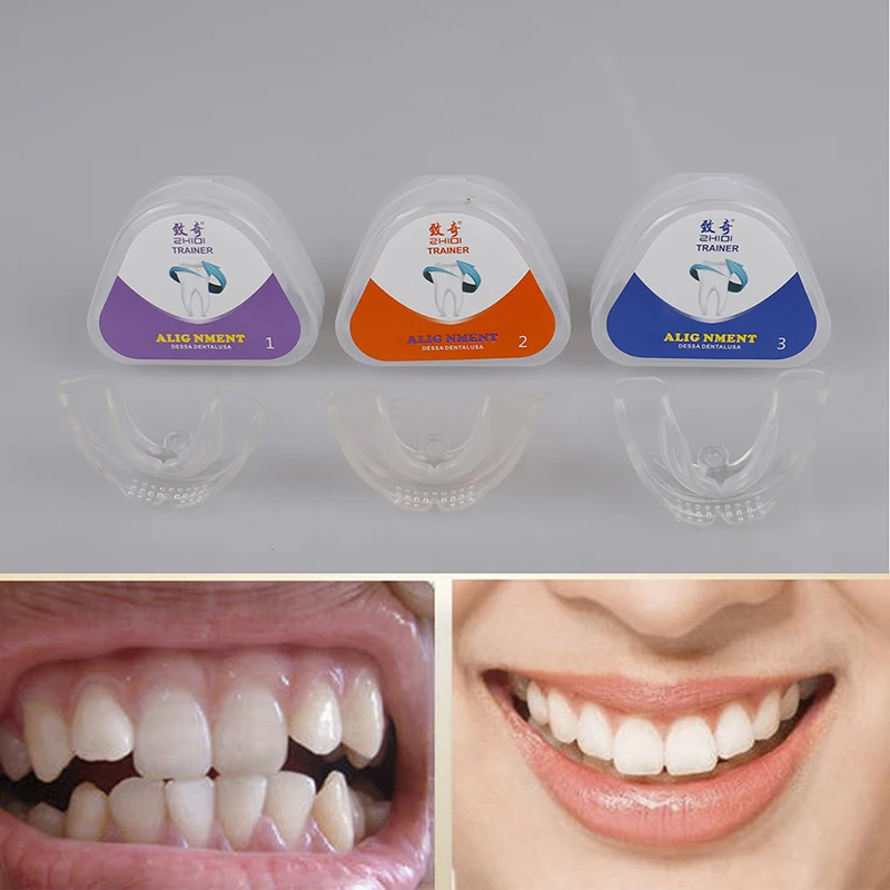 Orthodontic Braces Dental Instanted Silicone Smile Teeth Alignment Tray | Красота и здоровье