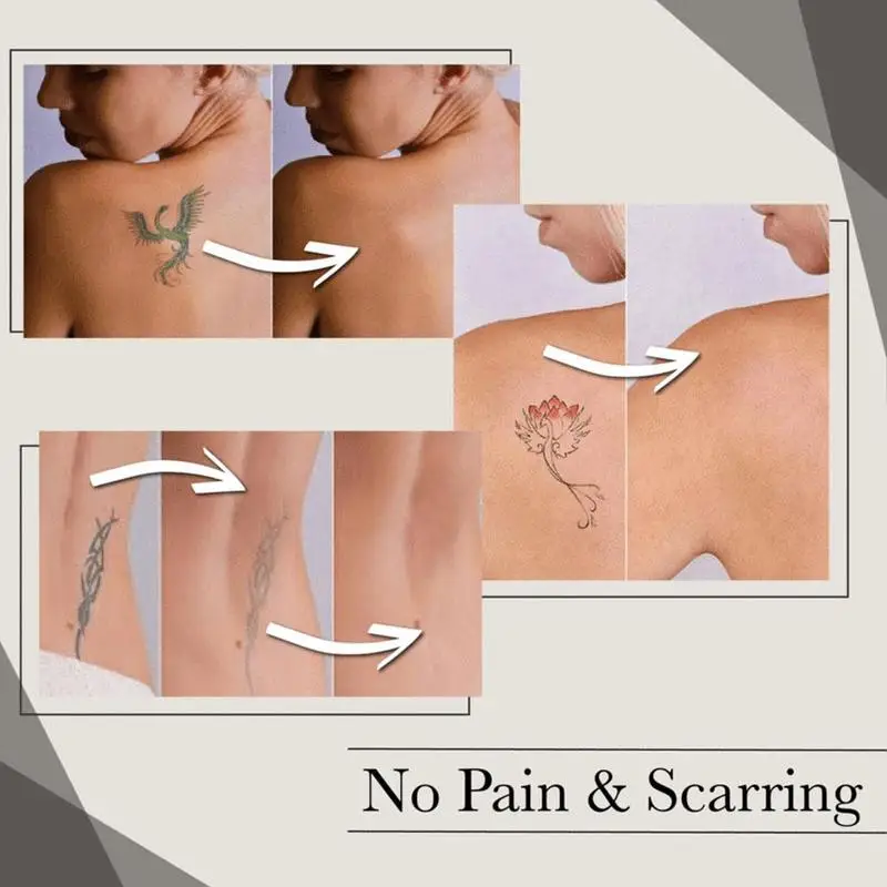 Шрам Татуировки маскирующее Обложка акне Знаки избавление от веснушек шрамов