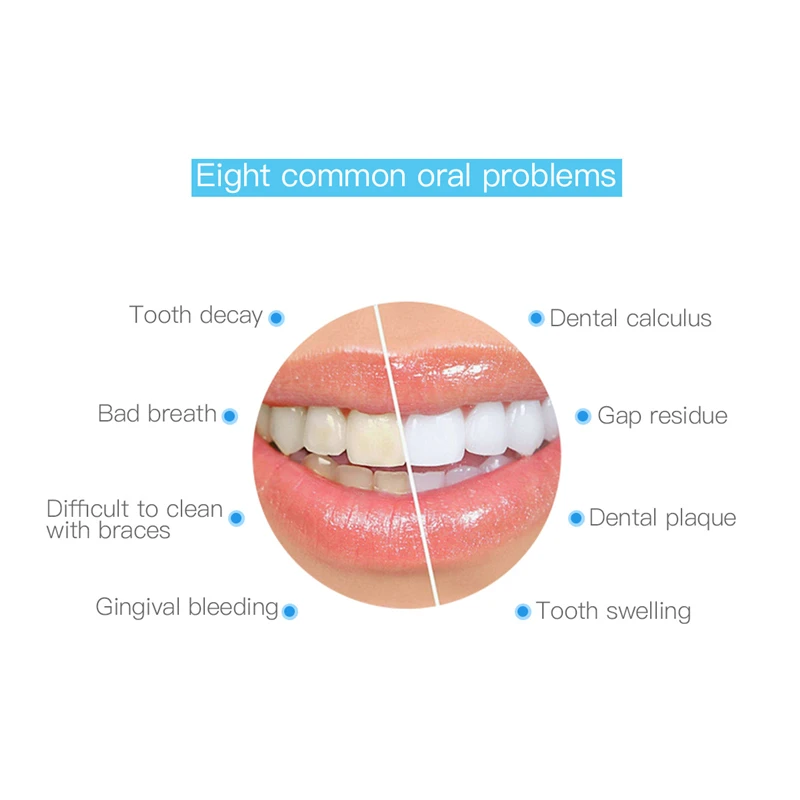 

Portable Electric Sonic Dental Scaler Tooth Calculus Remover Tooth Stains Tartar Tool Dentist Teeth Whitening Toothbrush USB