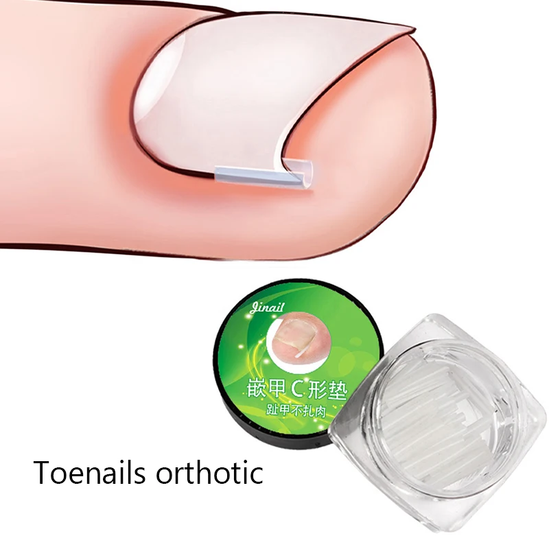 

10pcs/set Ingrown Nail Pad Ortho Nail Filling Nail Groove Pad Ingrown Nail Corrector Ingrown Nail Artifact