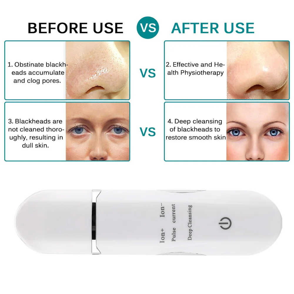 Прыщей Blackhead удалить ультразвуковой скребок для лица поры акне очищающий