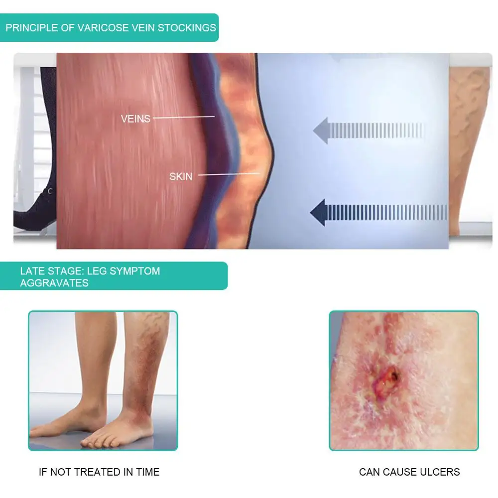 1 пара медицинских компрессионных носков 30-40 мм рт. Ст. тонкие носки до щиколотки