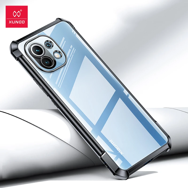 

For Xiaomi Mi 11 Case,Xundd Airbag Shockproof Shell,Electroplating Luxury Protective Case For Xiaomi Mi 11 5G Soft Tpu Cover