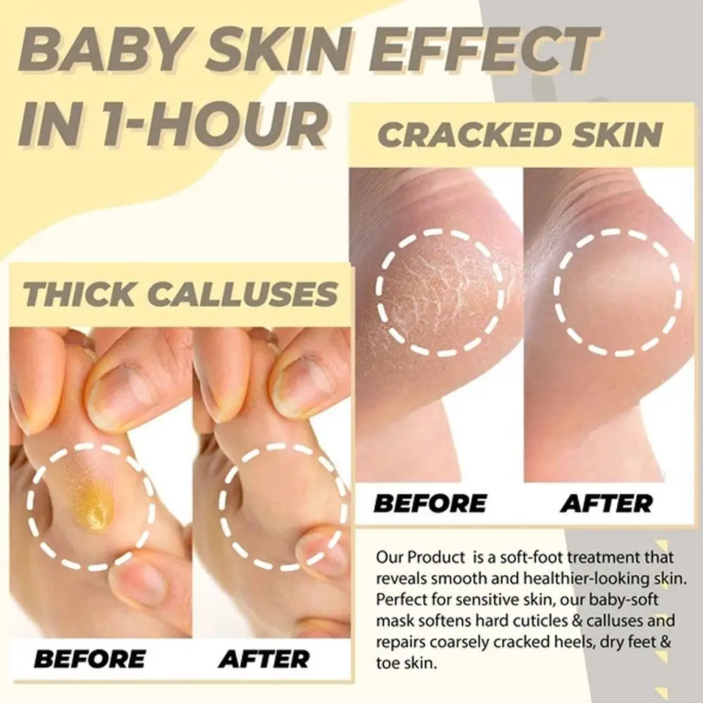 Aloe Foot Mask Peeling Repair Socks for Legs Remove Dead Skin Moisturizing Smooth Fruit Acid Exfoliating Patch | Красота и здоровье