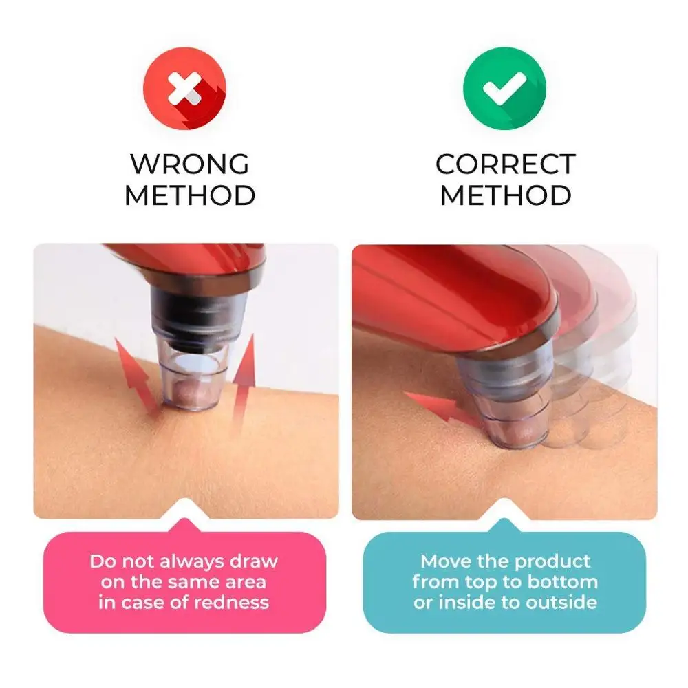 Средство для удаления угрей средство ухода за кожей лица глубокой поры акне