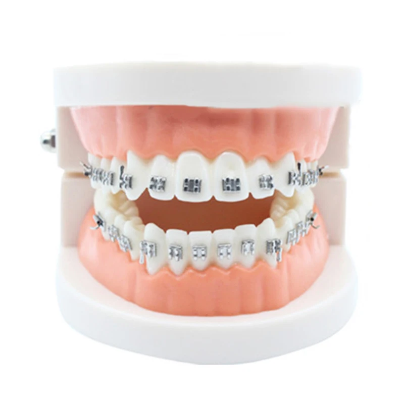 Модель стоматологической ортодонтической терапии с Орто металлическим