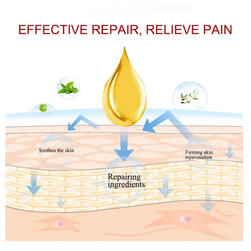 

Analgesic Cream Rheumatism Arthritis Ointment Muscle Sprain Knee Waist Pain 50G