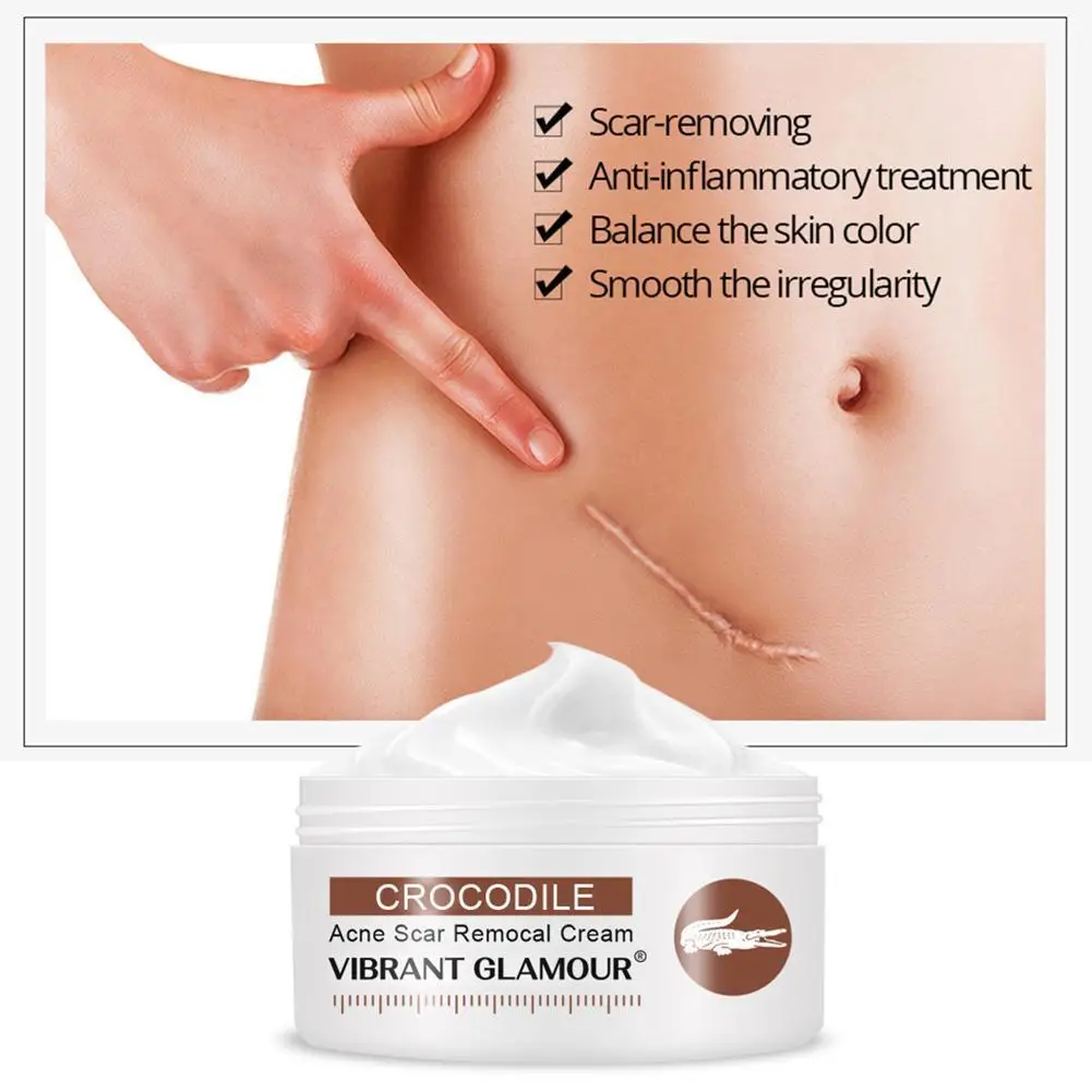 

Крем от шрамов и растяжек, 30 г, увлажняющий крем для лица, L7Z6