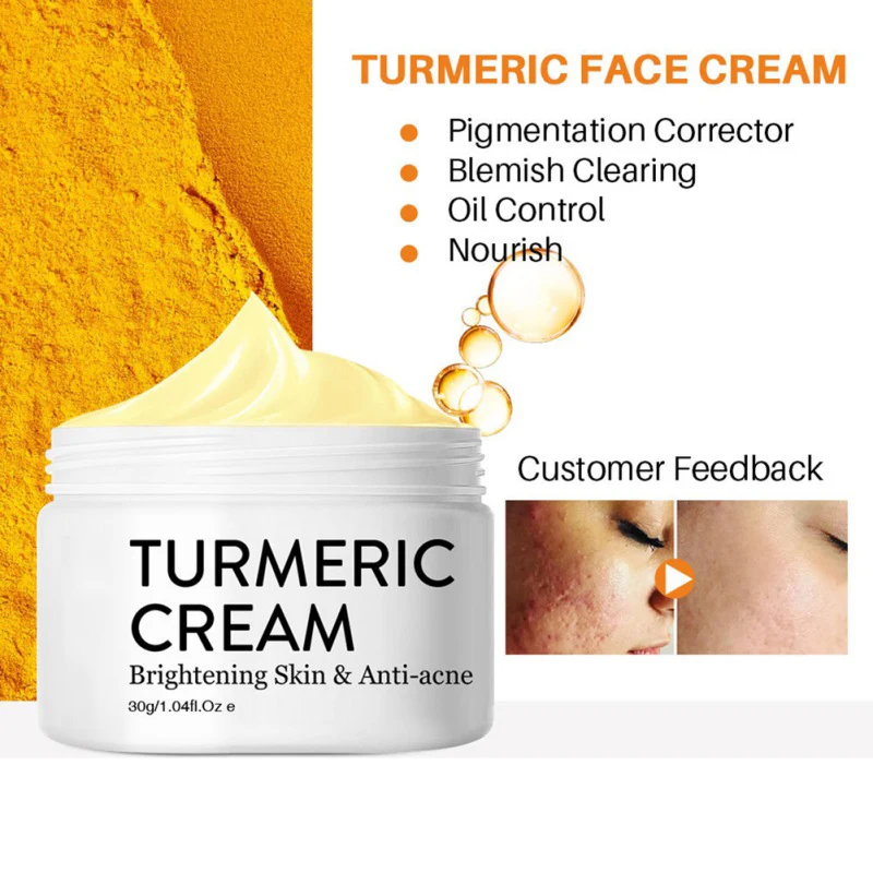 30 мл куркума угрей Лечение Уход за лицом крем ремонт шрам темное пятно
