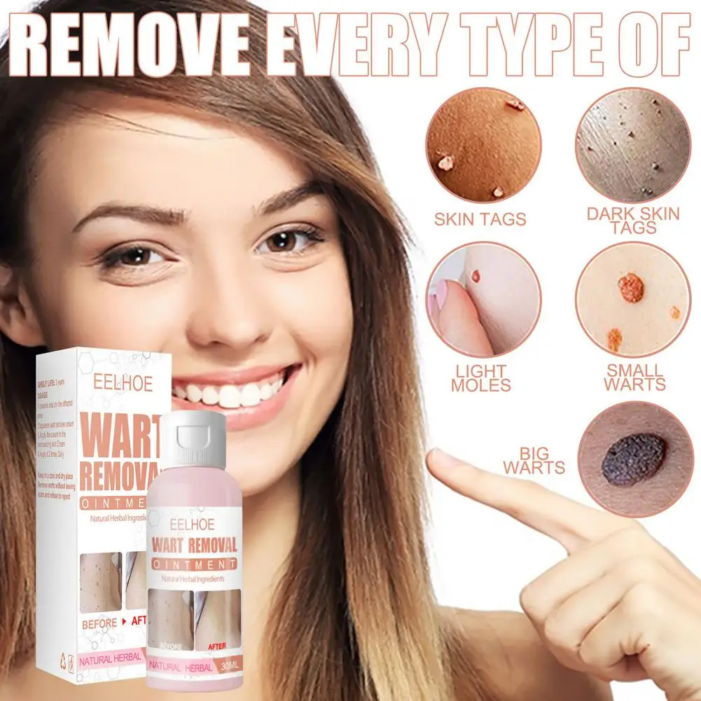 

Gentle Wart Remover Blemish Removal Gel Cream Skin Tag Solution