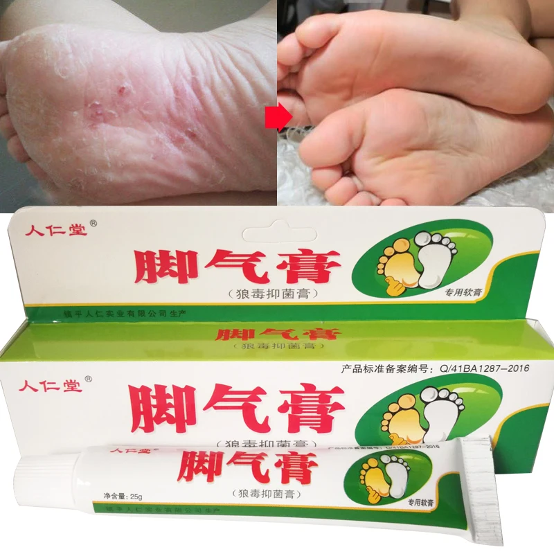 Крем для ухода за ногами средство от зуда эрозионная мазь ногами|Стопы| |