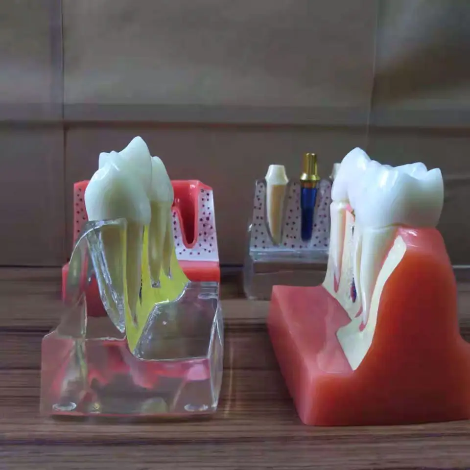 1 шт. 4 кратная модель имплантатов зубов орального обучения стоматологической