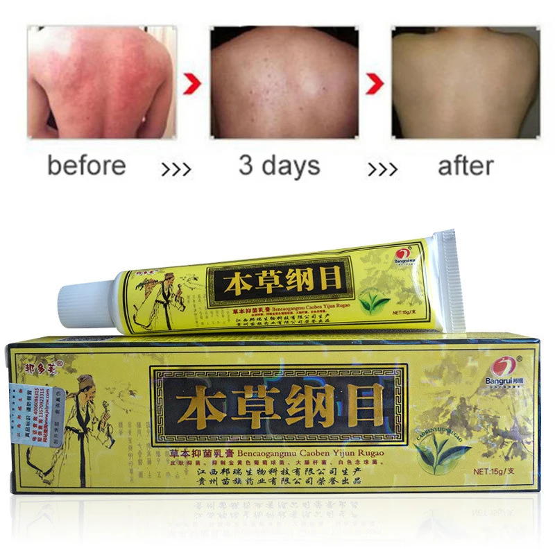 

Dropship Advanced Body Psoriasis Cream for Dermatitis and Eczema Pruritus Psoriasis Ointment Herbal Creams
