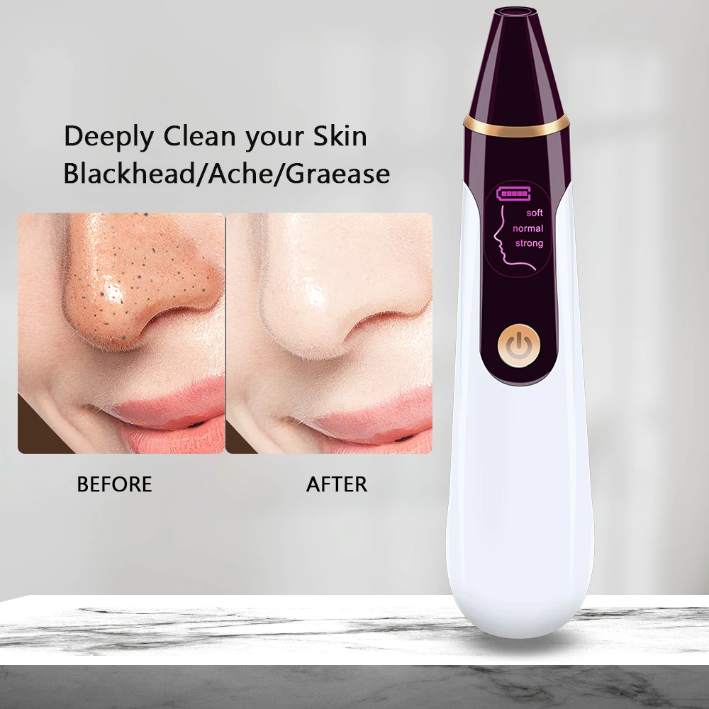 

Устройство для удаления черных точек с визуализацией, вакуумное удаление черных точек, удаление глубоких черных точек на лице, поры, акне, о...