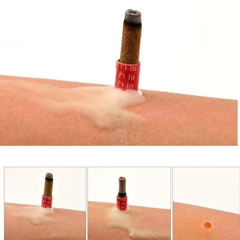 180pcs Mini Moxa Self Stick-On Chinese Moxibustion Therapy Mini Massage Heating Acupuncture Moxa Tube