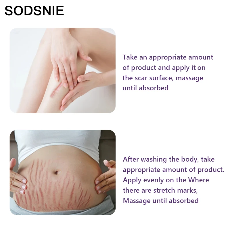 Натуральное масло для терапии кожи устраняет растяжки и шрамы восстанавливает