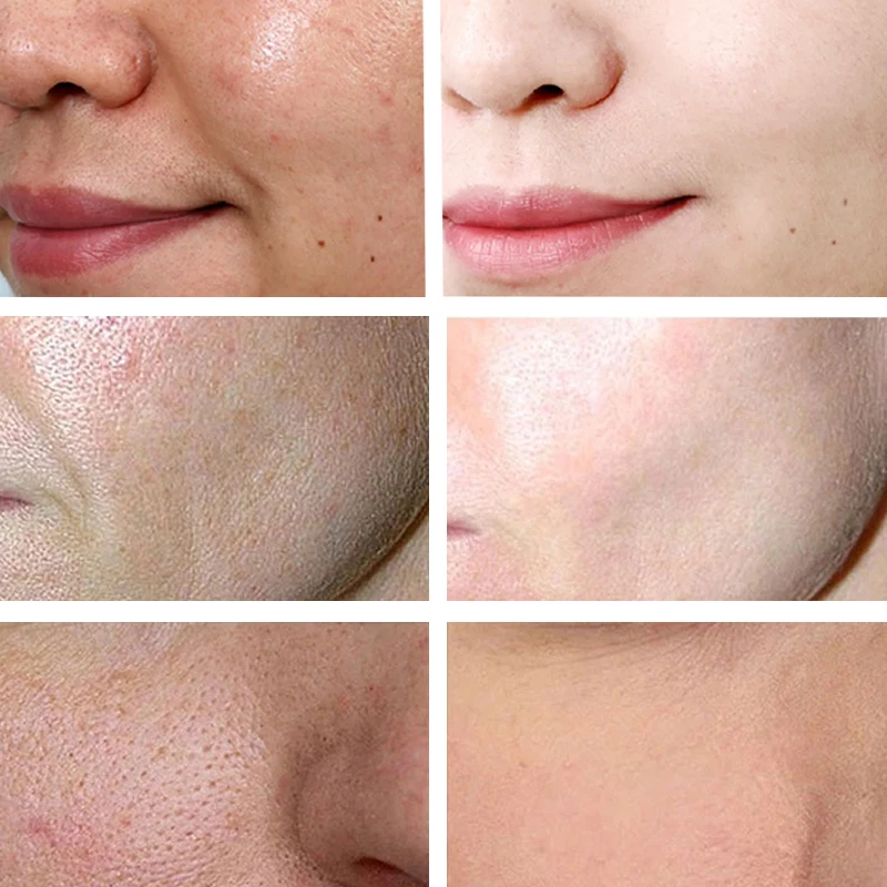 Рисунок 2 - Лосьон с гиалуроновой кислотой