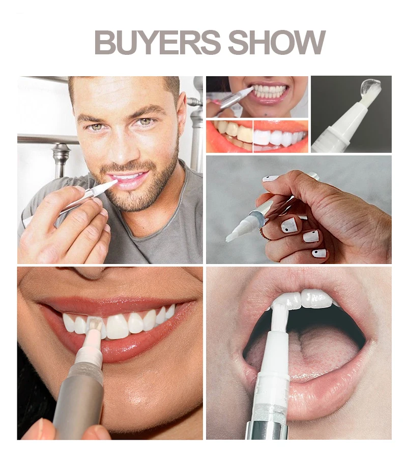 

AuQuest Teeth Whitening Pen PC Peroxide Tooth Gel Dental Oral Care Teeth Whitening Paste Bleaching Tools