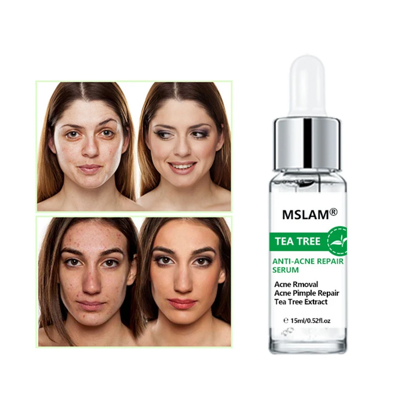 Набор для ухода за кожей лица с эссенцией чайного дерева Сыворотка крем кожи