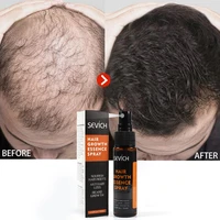 sevich hair growth spray serum ginger anti hair loss fast grow essence care products prevent hair dry frizzy hair easy to carry