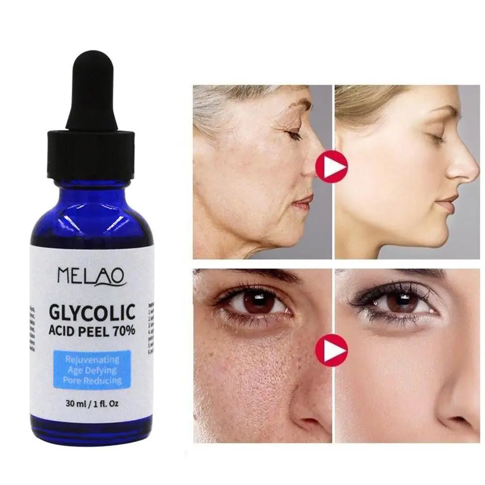 

30ml Glycolic Acid Peel Repair Solution Shrink Pores Skin Brighten Improve Color Skin Water Nourishing Acne Balance Oil C0C0