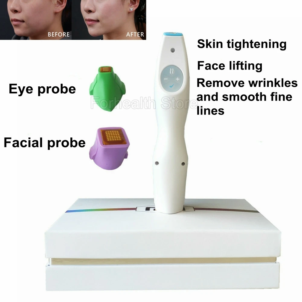 

Аппарат RF для подтяжки кожи вокруг глаз, для подтяжки кожи, удаления морщин и сужения пор, портативный массажер для лица, новинка 2021