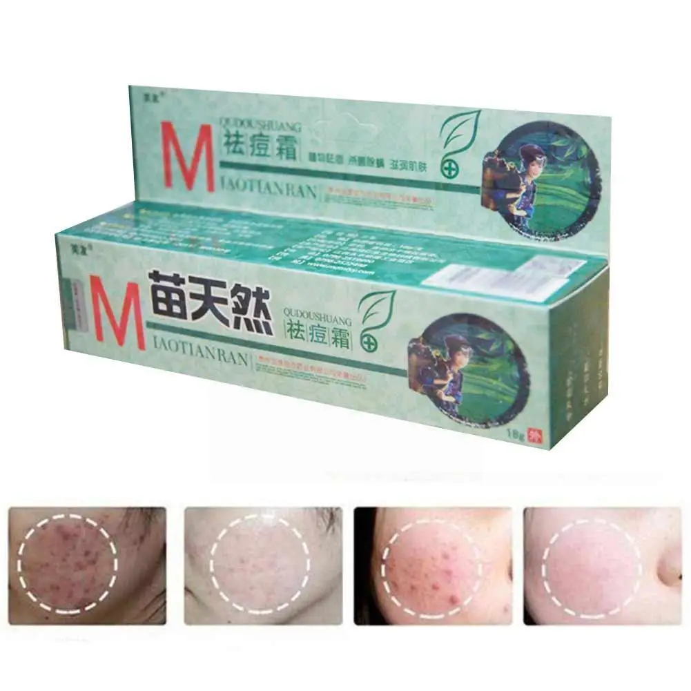 

Оригинальный Fuyou Miaotianran, крем от акне, бактерицидный крем для удаления клещей кожи, увлажняющий крем H2y0