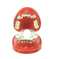 dental orthodontic teeth model with brackets and ligature wire affixed dental supplies