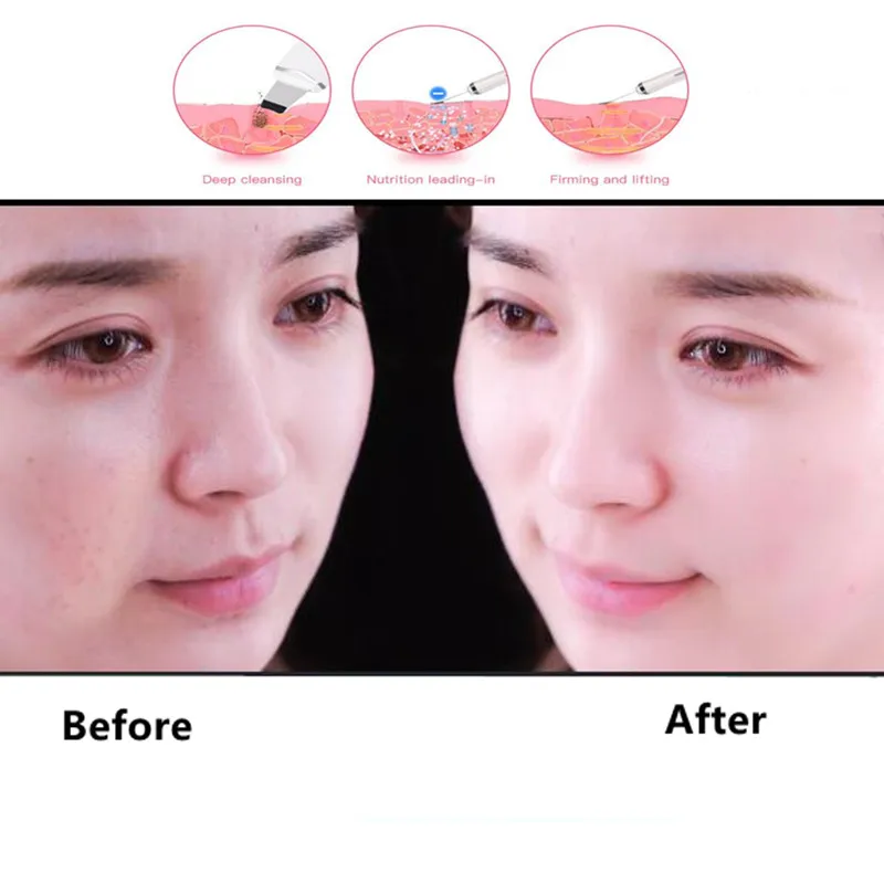 

Electric SPA Gentle Blackhead Remover Ultrasonic Facial Cleaner Skin Scrubber Facial Skin Scrubber Spatula Face Lifting Massager