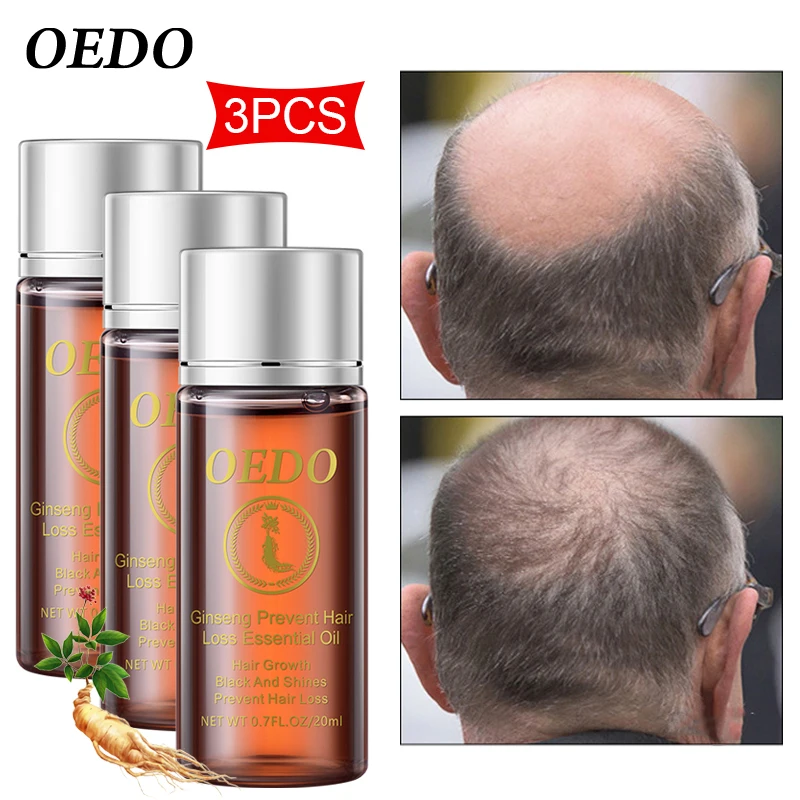 3 шт. быстрая эфирное масло для роста волос вылечит вас от облысения помогает