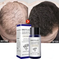 breylee hair fast growth essential oil hair scalp treatments prevent hair loss thinning repair beauty hair serum products 20ml