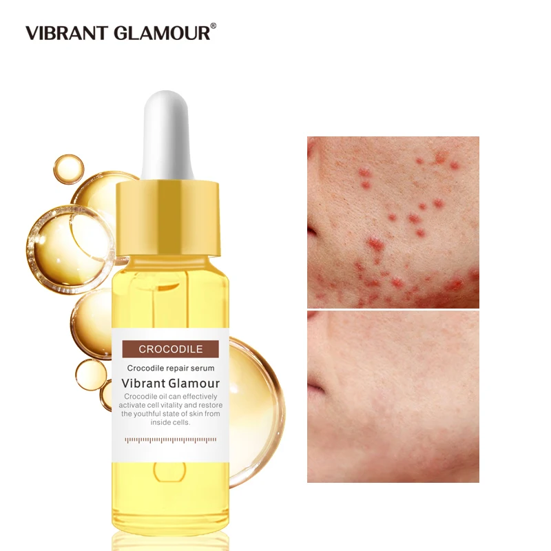 Живая Гламурная восстанавливающая сыворотка кожу от рубцов растяжек