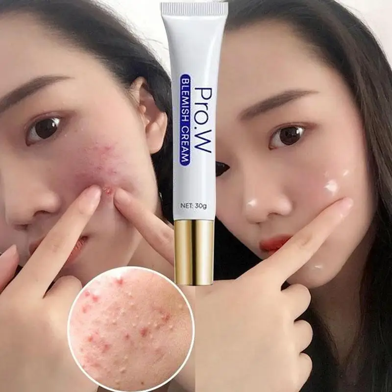 Vera Gel Face Moisturizer Anti Wrinkle Acne Scar Cream Care Z8M7 Skin Skin Sunscreen 100ml Acne Treatment F7T0