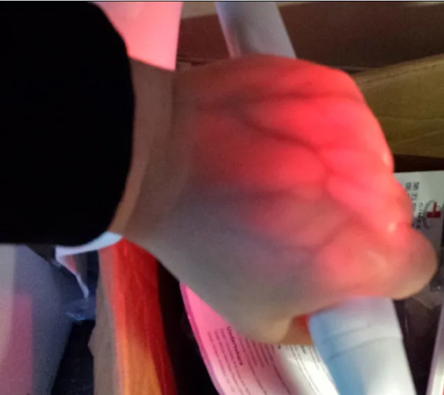 Высококачественные детские освещению вен локатор для визуализации ребенка