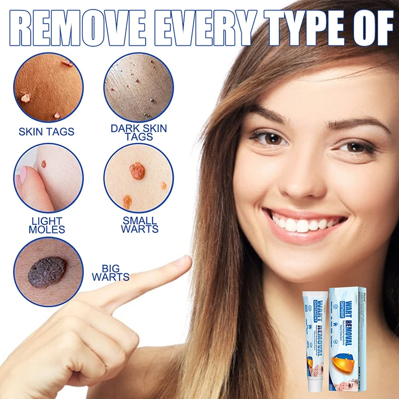 Newly Wart Remover Cream Skin Tag Removal Treatment with Natural Ingredients Body Supply |