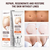 pregnancy scar removal acne cream anti aging anti wrinkle firming body cream stretch mark treatment maternal repair 45g