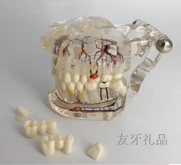 

Tooth model Adult transparent pathophysiological model Repair models Teaching demonstration free shipping