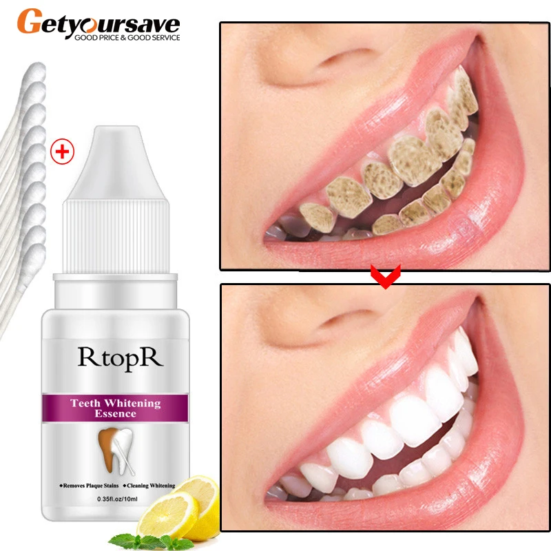 Отбеливание зубов в дополнение к неприятному дыханию быстрое и желтое пятна от