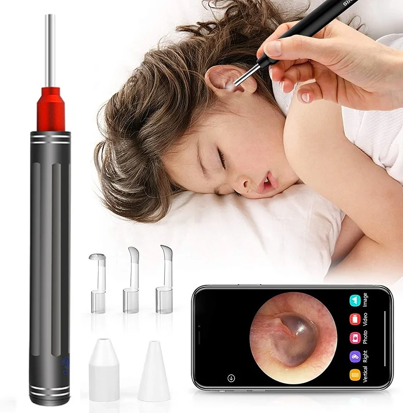 Умный ушной очиститель многофункциональный светящийся прибор для чистки ушей HD