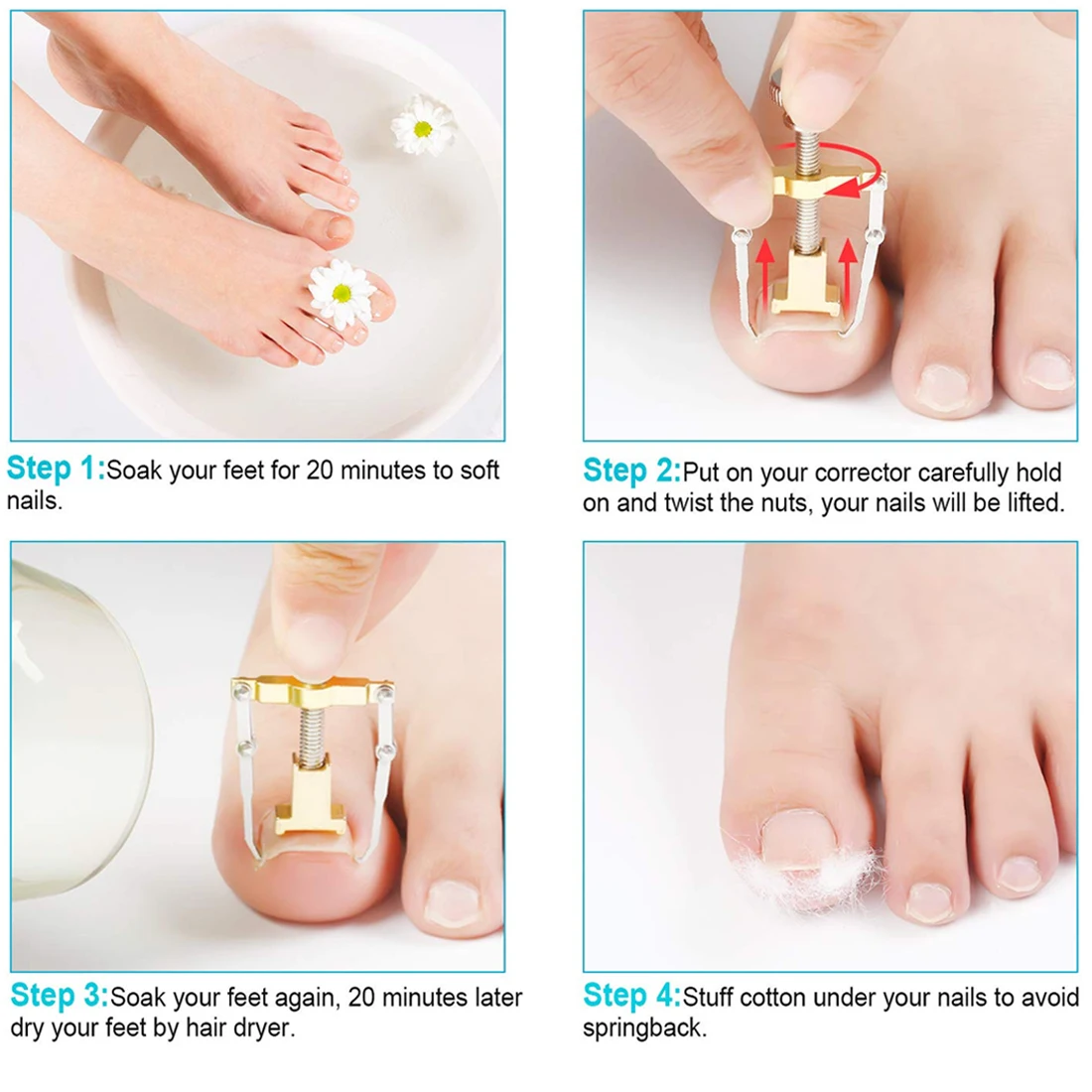 

Useful Ingrown Nail Foot Correction Tool Effective Treatment Ingrown Toenail Fixer Foot Care Nail Corrector Recovery Tools