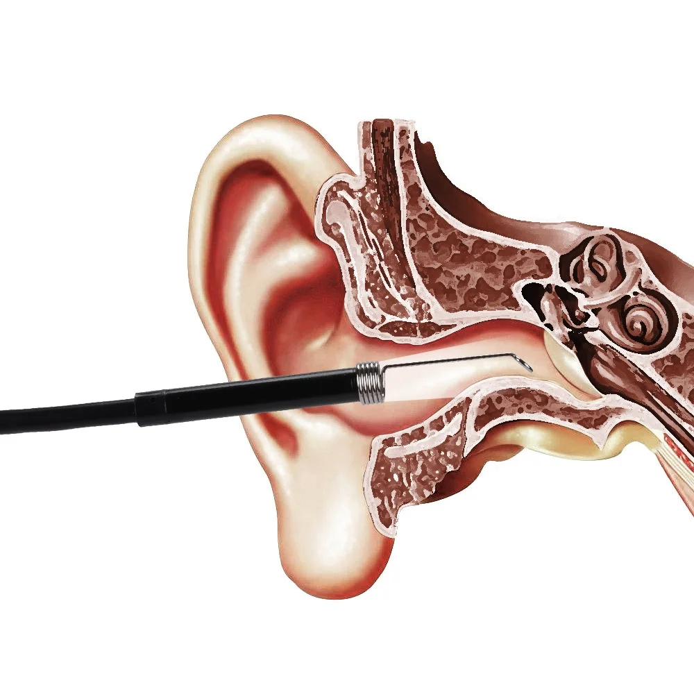 Эндоскоп для очистки ушей 3 в 1 USB HD визуальная Ушная ложка 5 мм мини камера Android PC