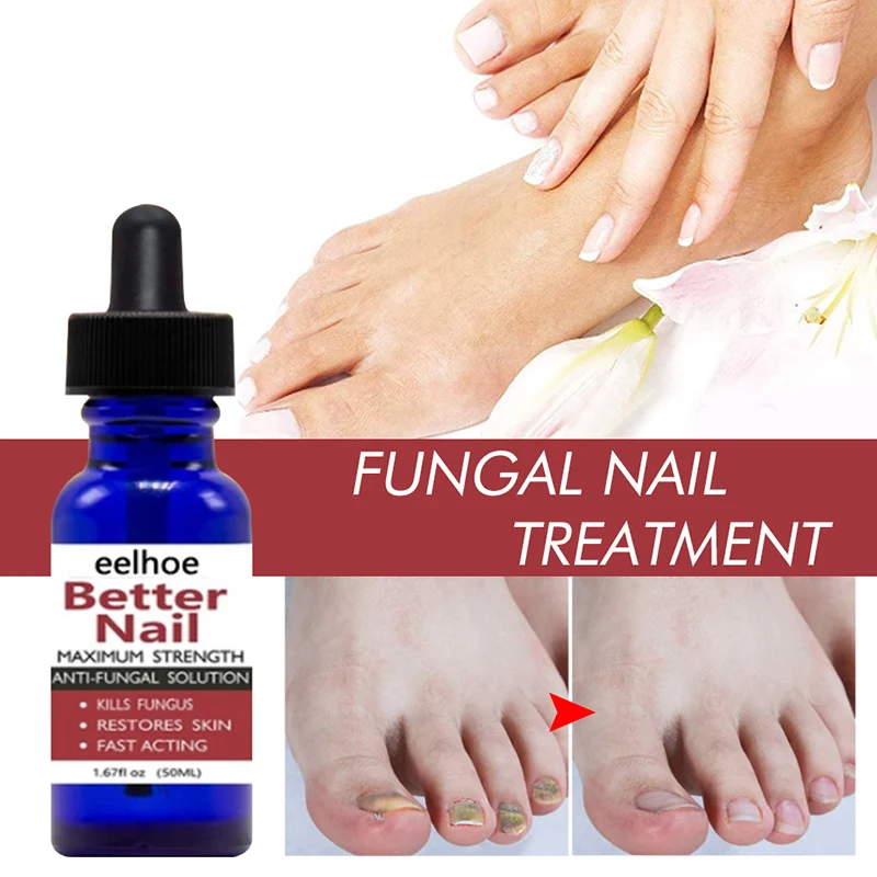 

Nail Repair Serum Liquid-Treatment Toe Nail Art Fungus Removal Anti-infective Paronychia Onychomycosis Essence Nail-Care 50ml