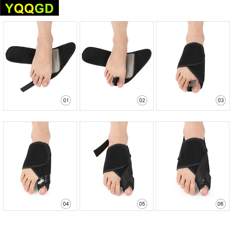 1 пара Bunion Splint выпрямитель для пальцев ног и корректор Скоба колодки вальгусная