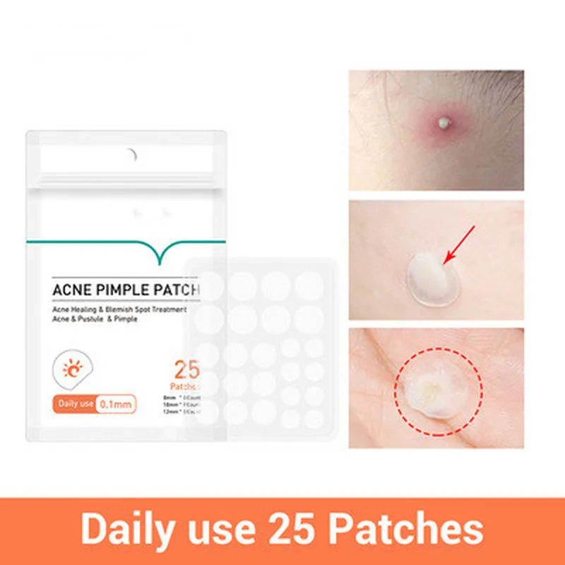 

Пластырь от прыщей и прыщей, маска для лица, невидимые наклейки от прыщей, средство для удаления прыщей, средство для ухода за кожей, крем для...